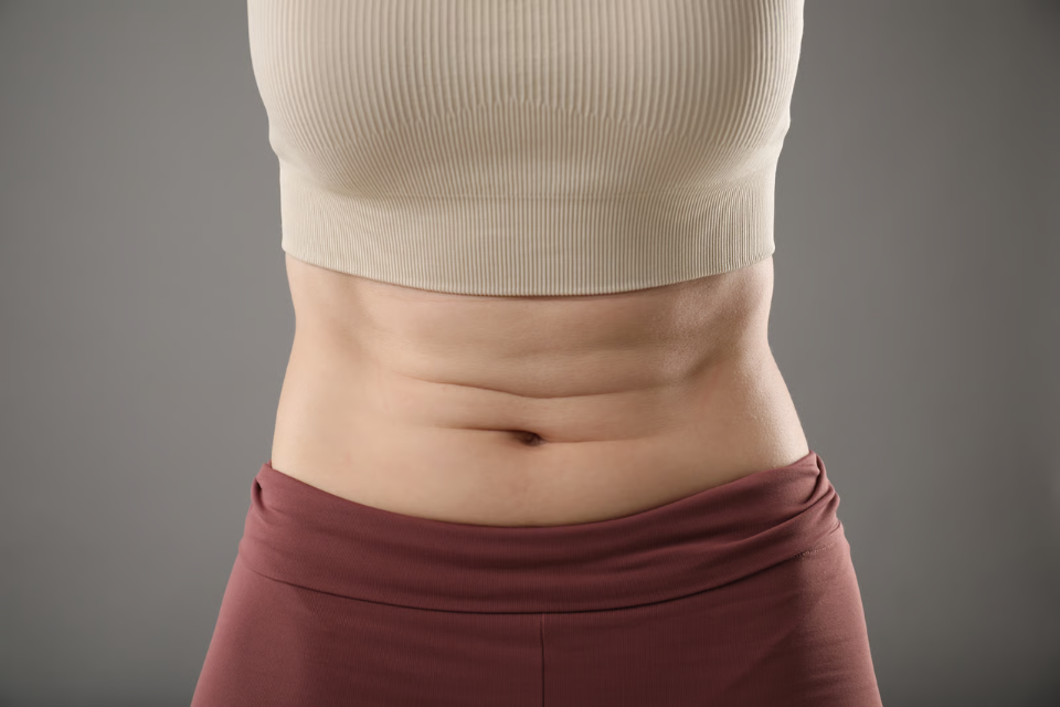 Close-up View of a Woman's Abdomen with Natural Skin Folds